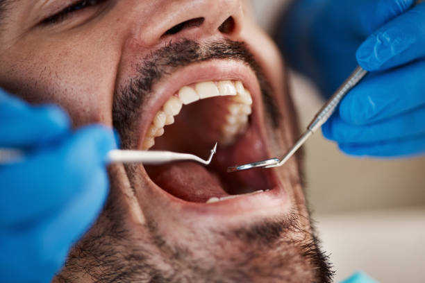 Best Emergency Broken Tooth Repair in Ventnor City, NJ